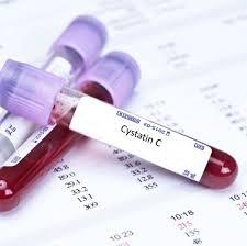 سیستاتین C، جایگزینی برای کراتینین